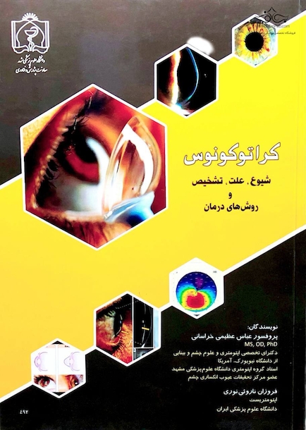 کراتوکونوس