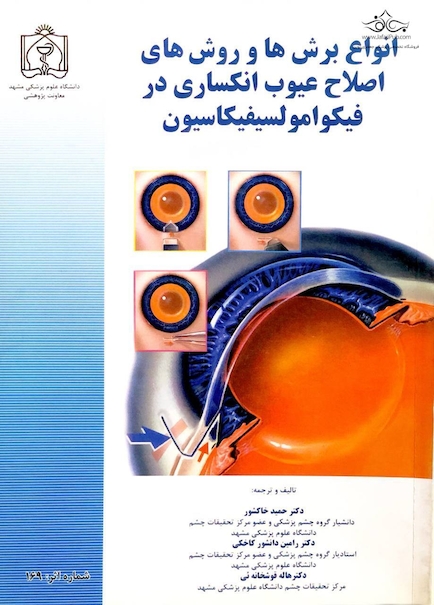 کتاب انواع برش ها و روش های اصلاح عیوب انکساری در فیکوامولسیفیکاسیون