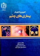 کتاب تصویربرداری در بیماری های چشم