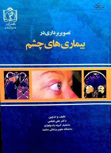 کتاب تصویربرداری در بیماری های چشم