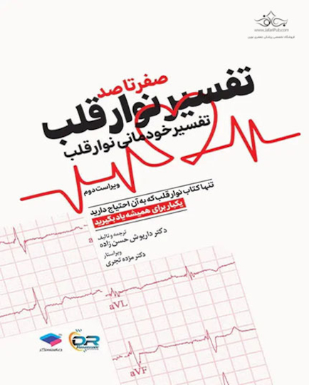 صفر تا صد تفسیر نوار قلب EKG به زبان ساده و خودمانی