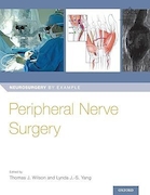 Peripheral Nerve Surgery | جراحی اعصاب محیطی