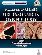 Donald School 3D-4D Ultrasound in Gynecology | سونوگرافی سه بعدی و چهار بعدی دونالد اسکول در زنان و زایمان