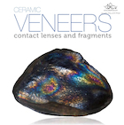 Ceramic Veneers: Contact Lenses and Fragments | ونیرهای سرامیکی: لنزهای تماسی و قطعات