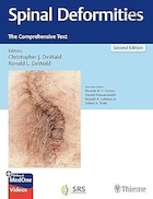 Spinal Deformities: The Comprehensive Text 2nd Edition | ناهنجاری های ستون فقرات: متن جامع، ویرایش دوم