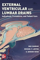 External Ventricular and Lumbar Drains: Indications, Procedures, and Patient Care 1st Edition | تخلیه های بطنی و کمری خارجی: موارد مصرف، روش ها و مراقبت از بیمار، ویرایش اول