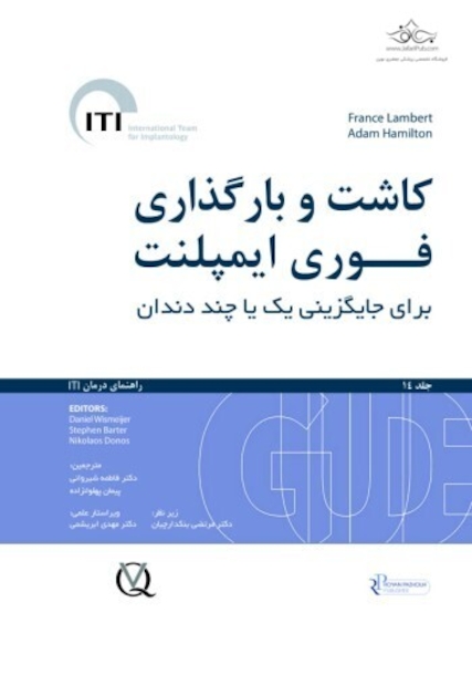 کاشت و بارگذاری فوری ایمپلنت برای جایگزینی یک یا چند دندان جلد 14 - راهنمای درمان ITI