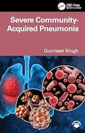 Severe Community-Acquired Pneumonia 1st Edition | پنومونی شدید اکتسابی از جامعه، ویرایش اول