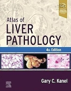 Atlas of Liver Pathology (Atlas of Surgical Pathology) 4th Edition | اطلس پاتولوژی کبد (اطلس پاتولوژی جراحی) ویرایش چهارم