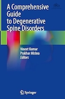 A Comprehensive Guide to Degenerative Spine Disorders | راهنمای جامع اختلالات دژنراتیو ستون فقرات