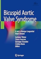 Bicuspid Aortic Valve Syndrome: A Not So Benign Congenital Heart Disease | سندرم دریچه آئورت دو لتی: یک بیماری مادرزادی قلبی نه چندان خوش خیم