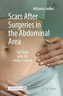 Scars After Surgeries in the Abdominal Area: Self-Help with the Liedler-Concept | جای زخم های بعد از جراحی در ناحیه شکم: خودیاری با مفهوم لیدلر