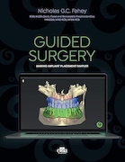 GUIDED SURGERY: Making implant placement simpler | جراحی هدایت شده: ساده تر کردن جایگذاری ایمپلنت