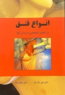 انواع فتق و راه های تشخیص و درمان آن ها