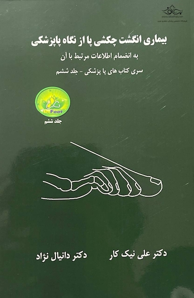 بیماری انگشت چکشی پا از نگاه پاپزشکی - جلد ششم