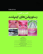 گام به گام با رستوریشن های ایمپلنت