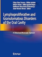 Lymphoproliferative and Granulomatous Disorders of the Oral Cavity | اختلالات لنفوپرولیفراتیو و گرانولوماتوز حفره دهان