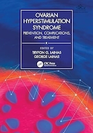 Ovarian Hyperstimulation Syndrome | سندرم تحریک بیش از حد تخمدان