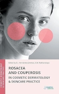 Rosacea and Couperosis in Cosmetic Dermatology & Skincare Practice | روزاسه و کوپروز در مراقبت های پوستی و زیبایی