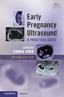 Early Pregnancy Ultrasound: A Practical Guide 2nd Edition | سونوگرافی اوایل بارداری: یک راهنمای عملی، ویرایش دوم