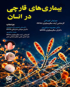 بیماری های قارچی در انسان