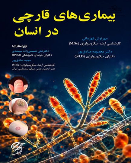 بیماری های قارچی در انسان