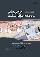 جراحی زیبایی مخاط لثه اطراف ایمپلنت - زوچلی 2022