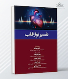 تفسیر نوار قلب