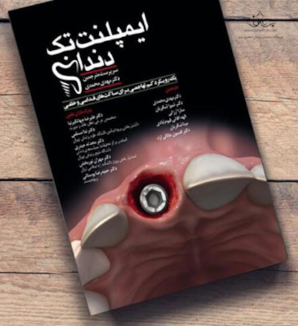 ایمپلنت تک دندان (یک رویکرد کم تهاجمی برای ساکت های قدامی و خلفی)