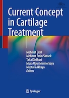 Current Concept in Cartilage Treatment | مفهوم فعلی در درمان غضروف