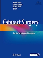 Cataract Surgery: Practice, Technique and Innovation | جراحی آب مروارید: تمرین، تکنیک و نوآوری
