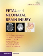 Fetal and Neonatal Brain Injury | آسیب مغزی جنین و نوزاد