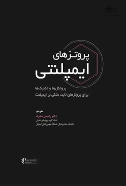 پروتزهای ایمپلنتی