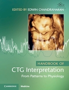 Handbook of CTG Interpretation | راهنمای تفسیر CTG