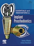 Essentials and Innovations in Implant Prosthodontics | اصول و نوآوری ها در پروتزهای ایمپلنت