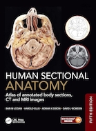 Human Sectional Anatomy: Atlas of annotated body sections, CT and MRI images | آناتومی مقطعی انسان: اطلس مقاطع بدن، تصاویر سی تی اسکن و ام آر آی همراه با توضیحات