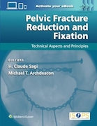 Pelvic Fracture Reduction and Fixation: Technical Aspects and Principles | جااندازی و تثبیت شکستگی لگن: جنبه های فنی و اصول
