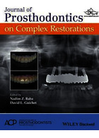 Journal of Prosthodontics on Complex Restorations | مجله پروتز در ترمیم های پیچیده