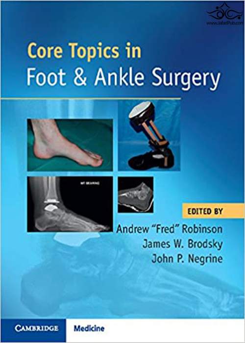 Core Topics in Foot and Ankle Surgery2018 Cambridge University Press