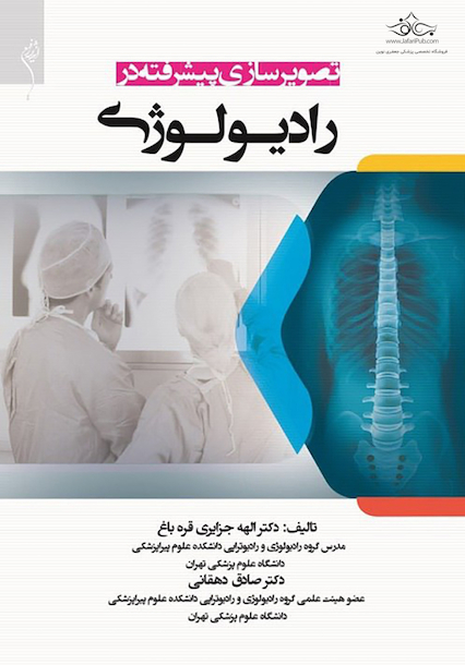 تصویرسازی پیشرفته در رادیولوژی