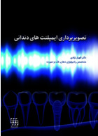 تصویربرداری ایمپلنت های دندانی