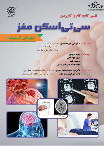 تفسیر گام به گام و کاربردی سی تی اسکن مغز (مقدماتی تا پیشرفته)
