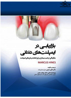 بازاریابی در ایمپلنت های دندانی چگونگی ترغیب بیماران برای انجام درمان های ایمپلنت