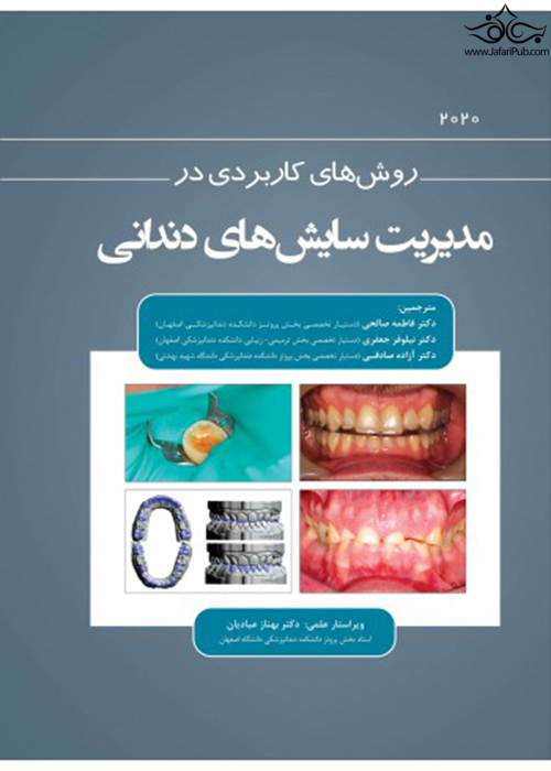 روش های کاربردی در مدیریت سایش های دندانی 2020 رویان پژوه