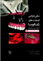 مبانی جراحی ایمپلنت های زایگوما (اصول دسترسی آناتومی)