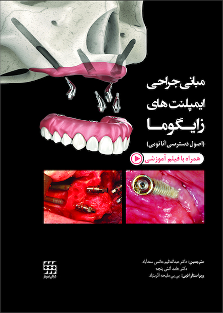 مبانی جراحی ایمپلنت های زایگوما (اصول دسترسی آناتومی)