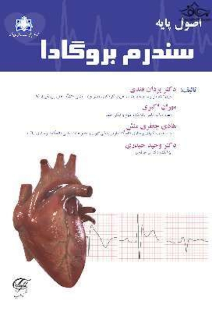 اصول پایه سندروم بروگادا