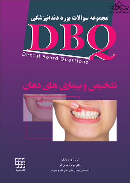 DBQ تشخیص و بیماری های دهان مجموعه سوالات بورد دندانپزشکی