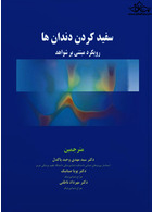 سفید کردن دندان ها رویکرد مبتنی بر شواهد