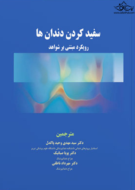 سفید کردن دندان ها رویکرد مبتنی بر شواهد